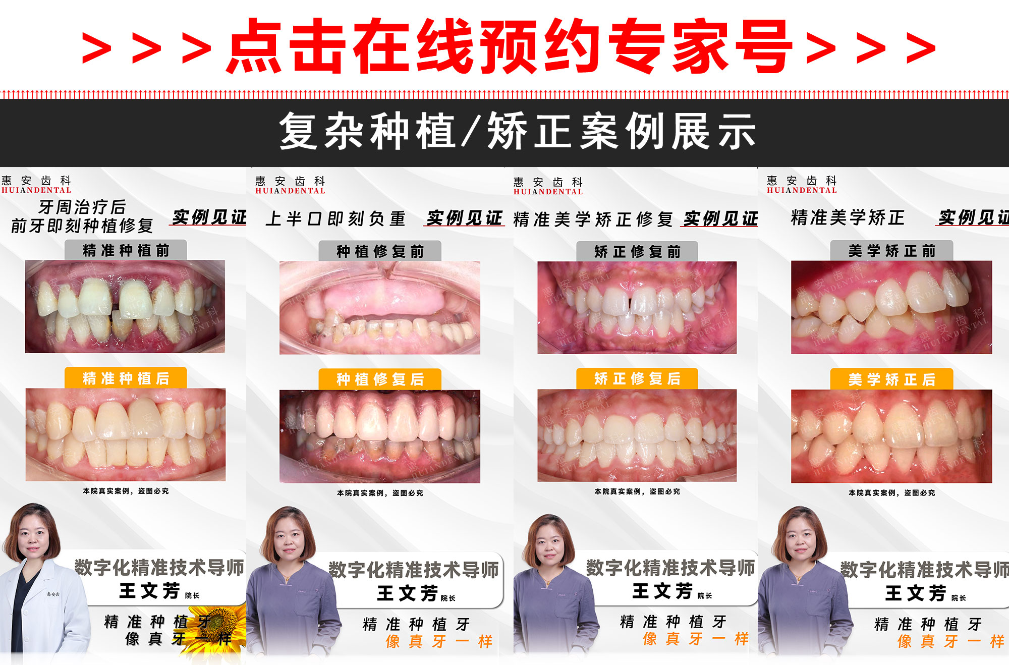 兰州惠安齿科医生，兰州惠安齿科种植专家，兰州惠安齿科矫正医生，兰州惠安齿科专家