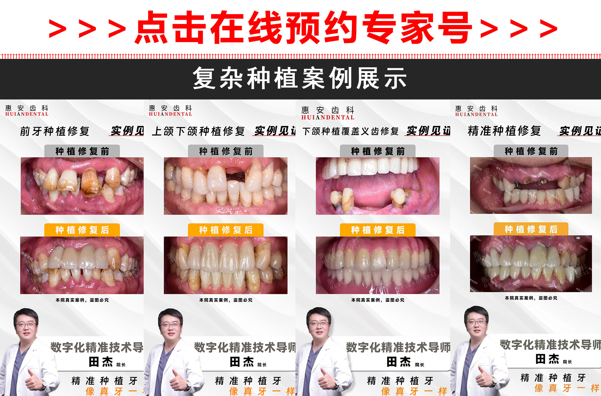 兰州惠安齿科医生，兰州惠安齿科专家，兰州惠安齿科种植专家，兰州种植牙医生